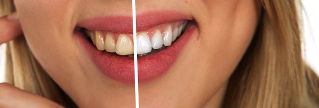 zuby před a po